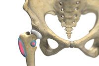 Hip Image Hip