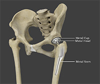 Hip Image Hip