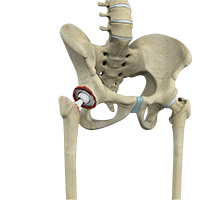 Hip Image Hip