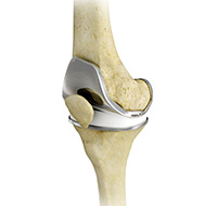 Knee Image Knee