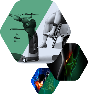 Mako Robotic-Arm Assisted Technology